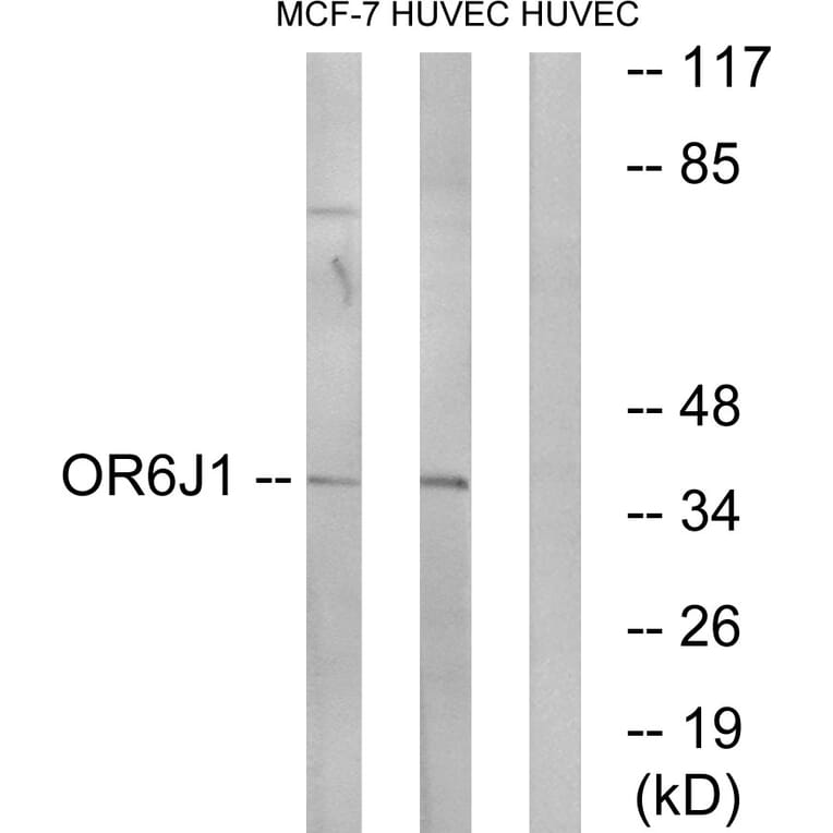 Western Blot - Anti-OR6J1 Antibody (G922) - Antibodies.com