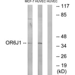 Western Blot - Anti-OR6J1 Antibody (G922) - Antibodies.com