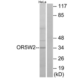 Western Blot - Anti-OR5W2 Antibody (G657) - Antibodies.com