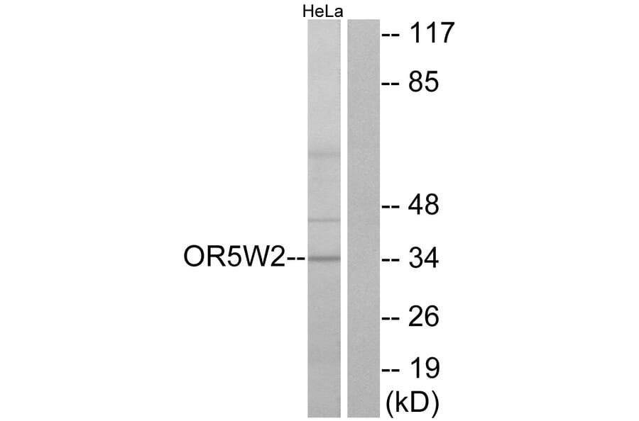 Western Blot - Anti-OR5W2 Antibody (G657) - Antibodies.com