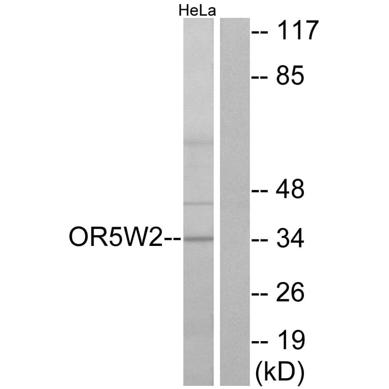 Western Blot - Anti-OR5W2 Antibody (G657) - Antibodies.com