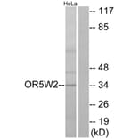 Western Blot - Anti-OR5W2 Antibody (G657) - Antibodies.com