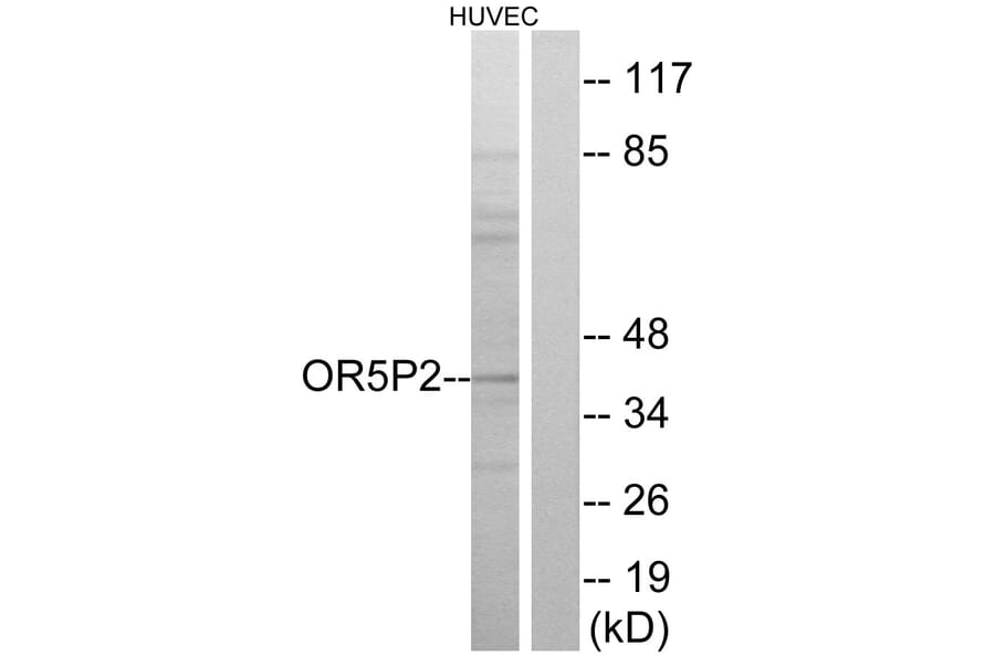 Western Blot - Anti-OR5P2 Antibody (G651) - Antibodies.com