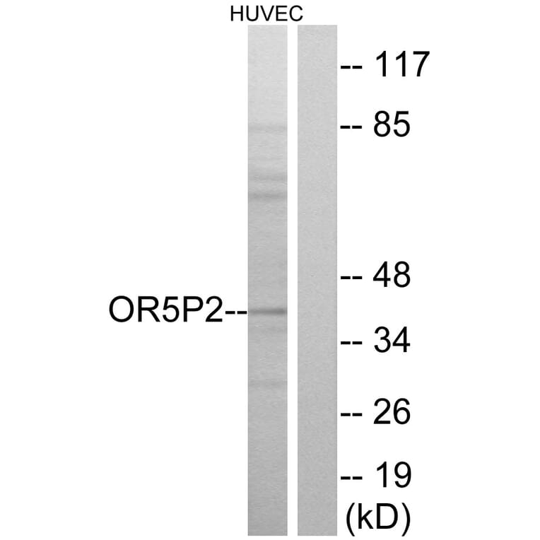 Western Blot - Anti-OR5P2 Antibody (G651) - Antibodies.com