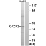 Western Blot - Anti-OR5P2 Antibody (G651) - Antibodies.com