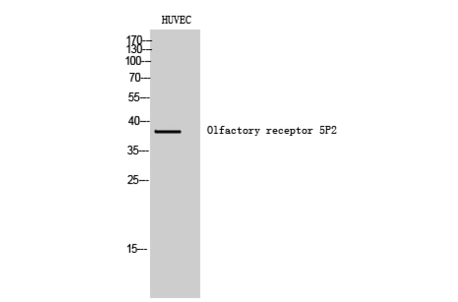 Western Blot - Anti-OR5P2 Antibody (G651) - Antibodies.com