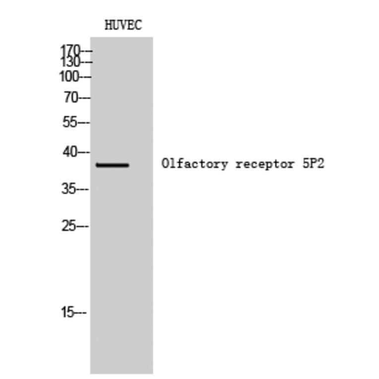 Western Blot - Anti-OR5P2 Antibody (G651) - Antibodies.com