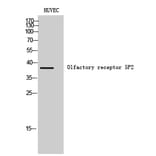 Western Blot - Anti-OR5P2 Antibody (G651) - Antibodies.com