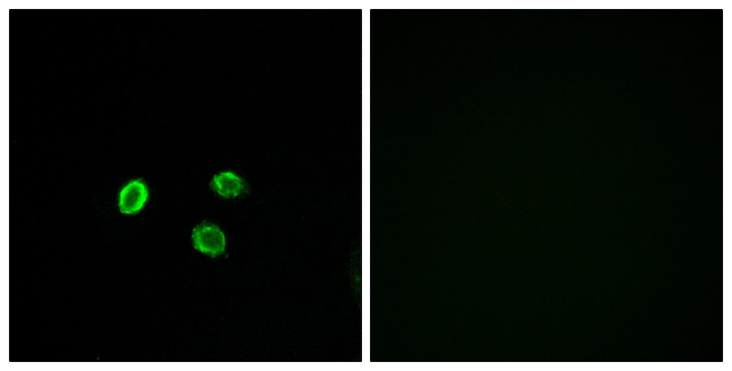 Immunofluorescence analysis of MCF7 cells using Anti-OR5M9 Antibody. The right hand panel represents a negative control, where the antibody was pre-incubated with the immunising peptide.