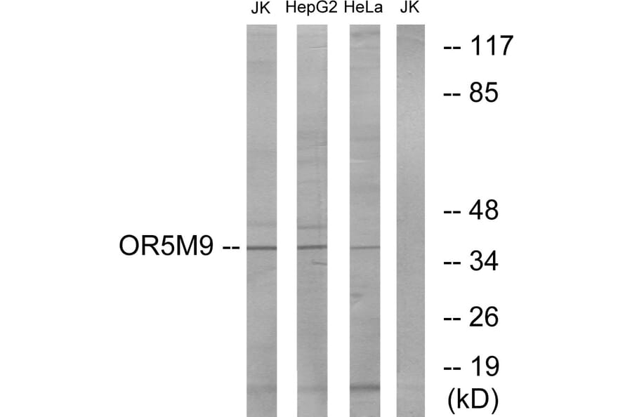 Western Blot - Anti-OR5M9 Antibody (G650) - Antibodies.com