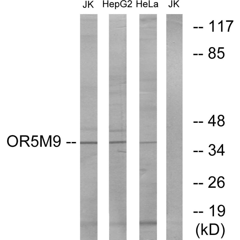Western Blot - Anti-OR5M9 Antibody (G650) - Antibodies.com