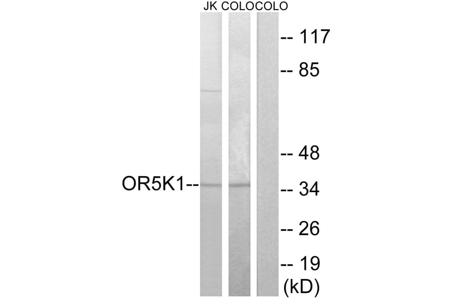 Western Blot - Anti-OR5K1 Antibody (G642) - Antibodies.com
