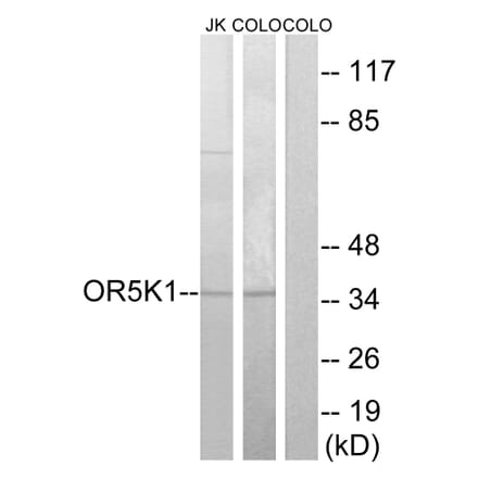 Western Blot - Anti-OR5K1 Antibody (G642) - Antibodies.com