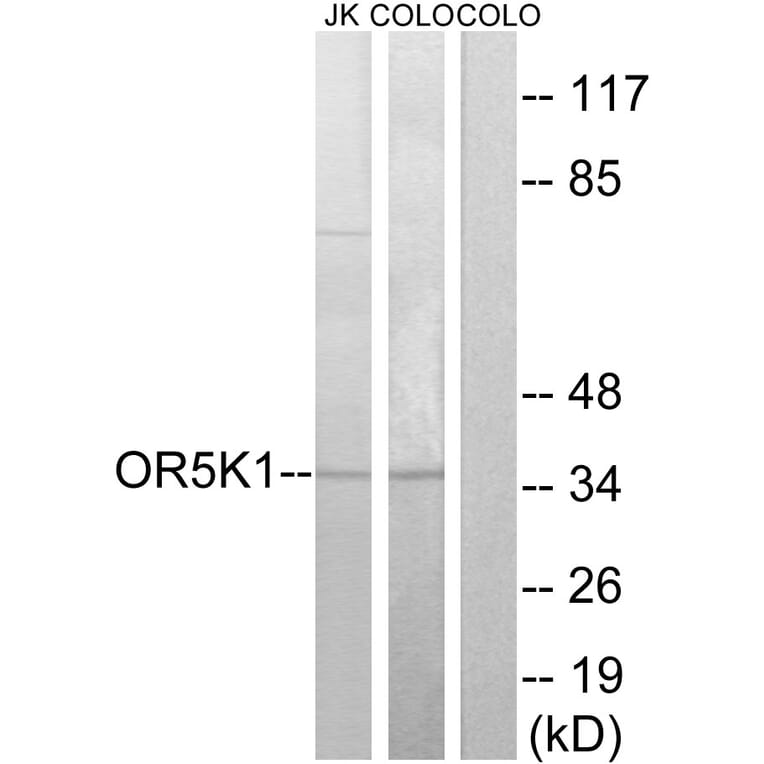 Western Blot - Anti-OR5K1 Antibody (G642) - Antibodies.com