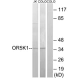Western Blot - Anti-OR5K1 Antibody (G642) - Antibodies.com