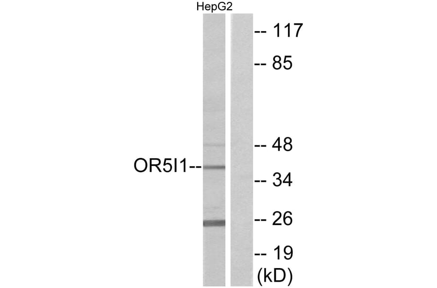 Western Blot - Anti-OR5I1 Antibody (G641) - Antibodies.com