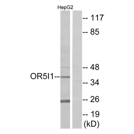 Western Blot - Anti-OR5I1 Antibody (G641) - Antibodies.com