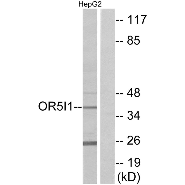 Western Blot - Anti-OR5I1 Antibody (G641) - Antibodies.com