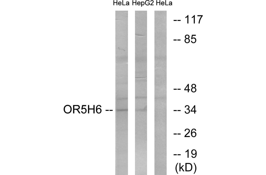 Western Blot - Anti-OR5H6 Antibody (G640) - Antibodies.com