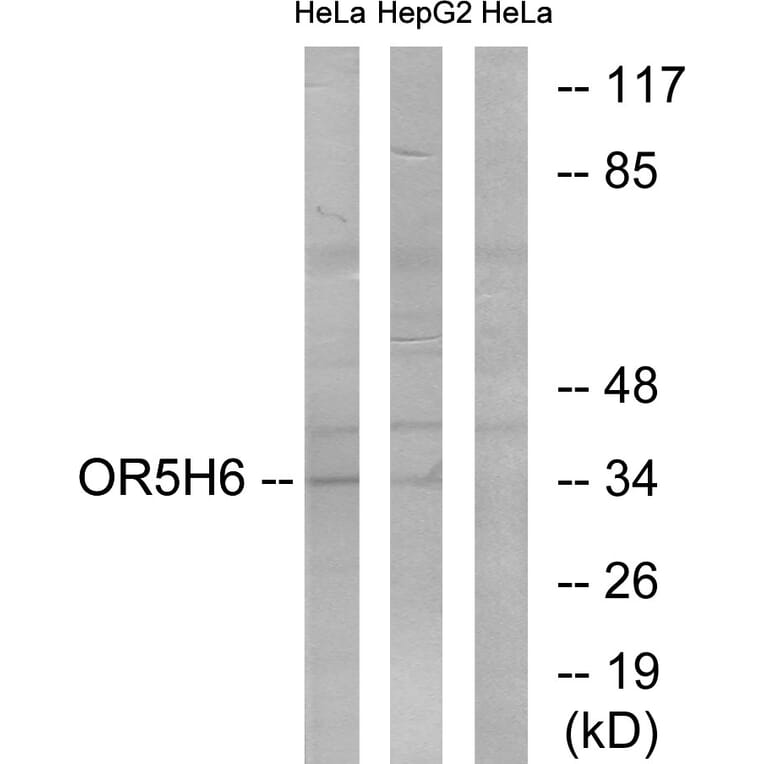 Western Blot - Anti-OR5H6 Antibody (G640) - Antibodies.com