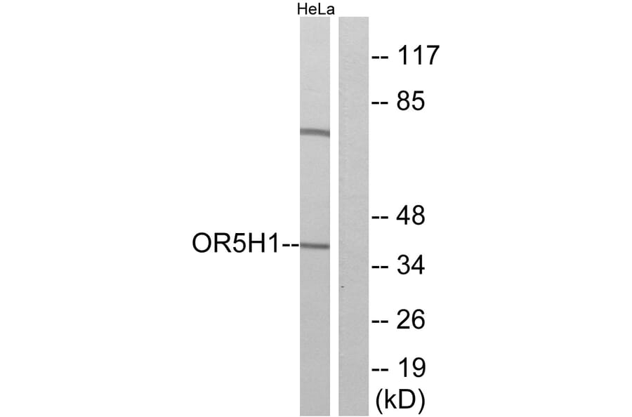 Western Blot - Anti-OR5H1 Antibody (G638) - Antibodies.com