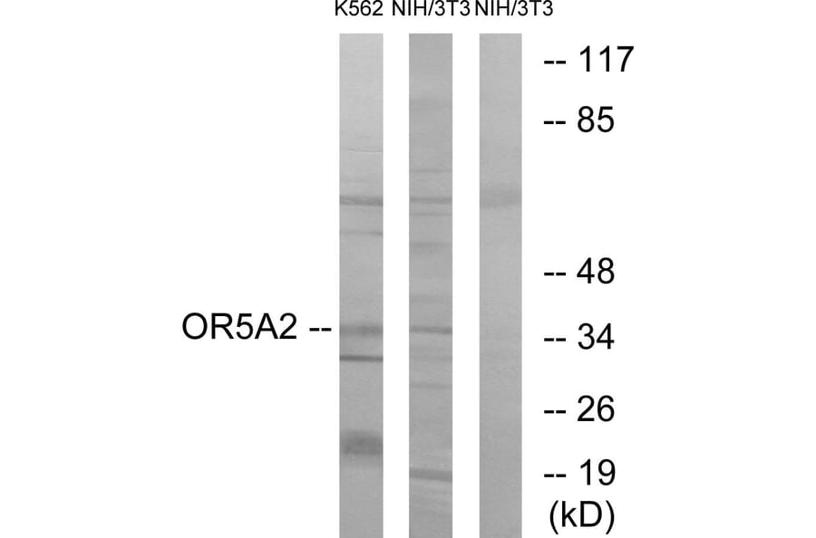 Western Blot - Anti-OR5A2 Antibody (G622) - Antibodies.com