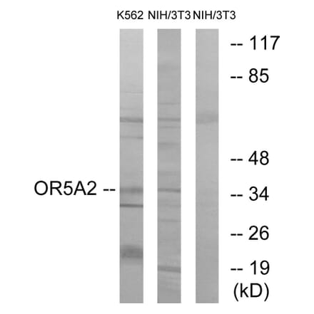 Western Blot - Anti-OR5A2 Antibody (G622) - Antibodies.com