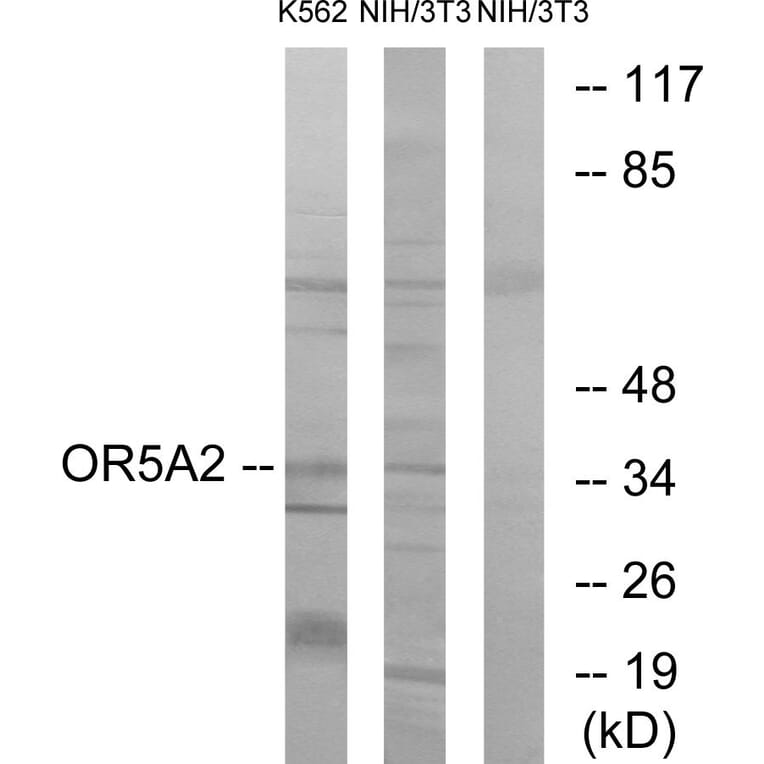 Western Blot - Anti-OR5A2 Antibody (G622) - Antibodies.com