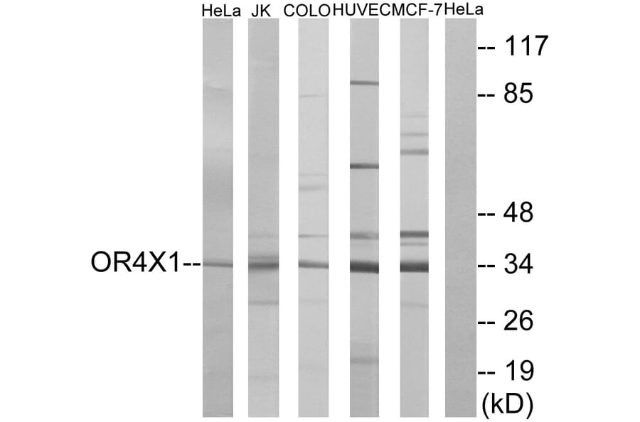 Western Blot - Anti-OR4X1 Antibody (G616) - Antibodies.com
