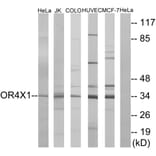 Western Blot - Anti-OR4X1 Antibody (G616) - Antibodies.com