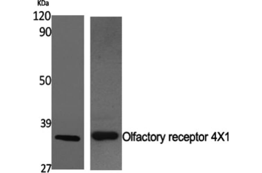 Western Blot - Anti-OR4X1 Antibody (G616) - Antibodies.com