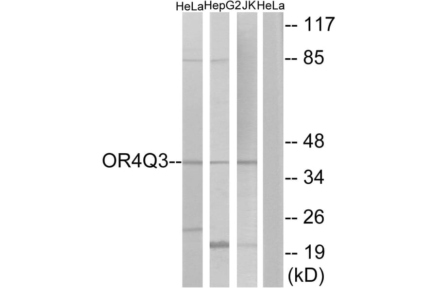 Western Blot - Anti-OR4Q3 Antibody (G613) - Antibodies.com