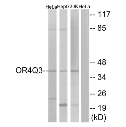 Western Blot - Anti-OR4Q3 Antibody (G613) - Antibodies.com