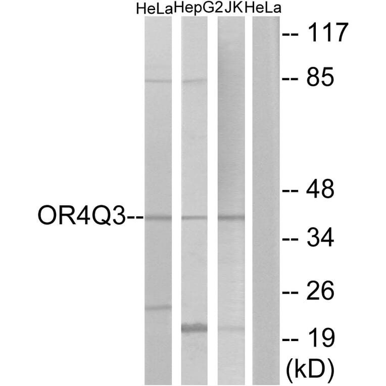 Western Blot - Anti-OR4Q3 Antibody (G613) - Antibodies.com