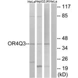 Western Blot - Anti-OR4Q3 Antibody (G613) - Antibodies.com