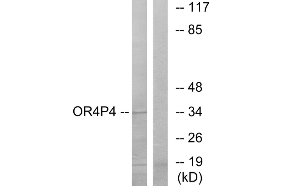 Western Blot - Anti-OR4P4 Antibody (G612) - Antibodies.com