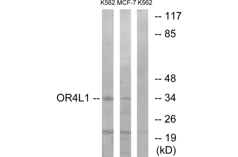 Western Blot - Anti-OR4L1 Antibody (G608) - Antibodies.com