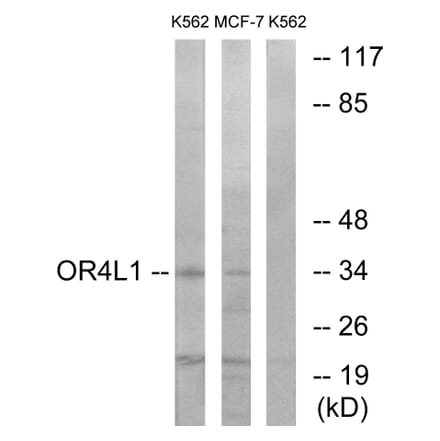 Western Blot - Anti-OR4L1 Antibody (G608) - Antibodies.com