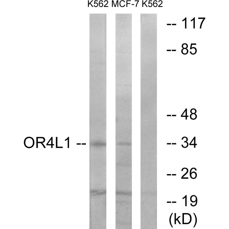 Western Blot - Anti-OR4L1 Antibody (G608) - Antibodies.com