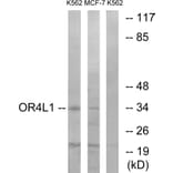 Western Blot - Anti-OR4L1 Antibody (G608) - Antibodies.com