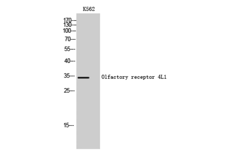 Western Blot - Anti-OR4L1 Antibody (G608) - Antibodies.com