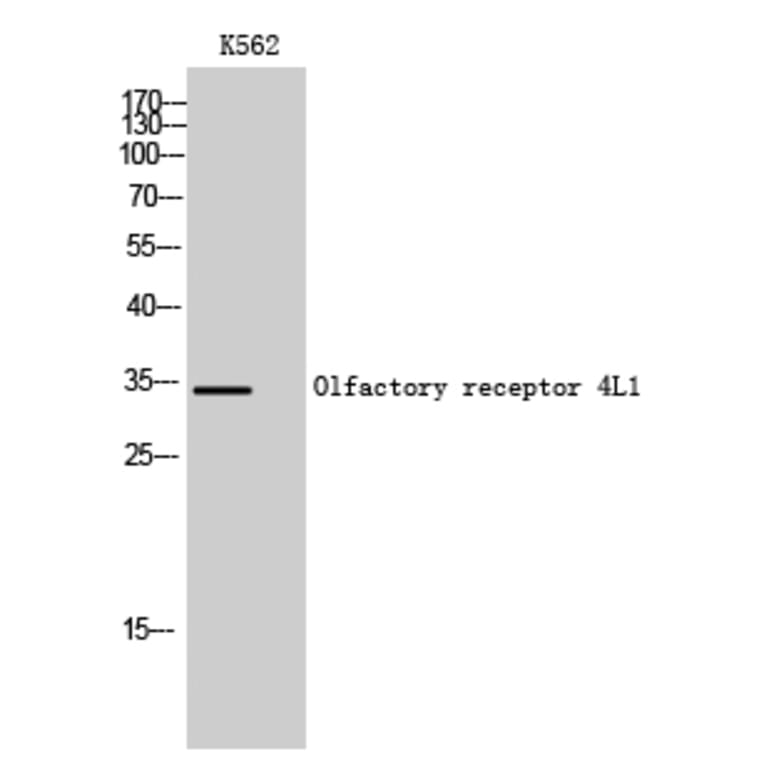 Western Blot - Anti-OR4L1 Antibody (G608) - Antibodies.com