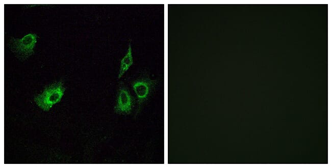Immunofluorescence analysis of A549 cells using Anti-OR4K3 Antibody. The right hand panel represents a negative control, where the antibody was pre-incubated with the immunising peptide.