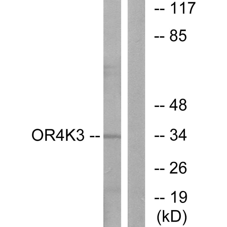 Western Blot - Anti-OR4K3 Antibody (G603) - Antibodies.com