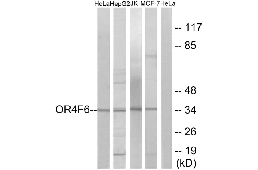 Western Blot - Anti-OR4F6 Antibody (G600) - Antibodies.com