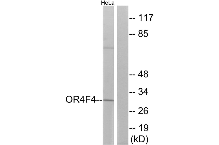 Western Blot - Anti-OR4F4 Antibody (G599) - Antibodies.com