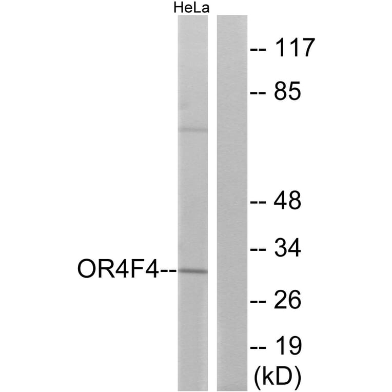 Western Blot - Anti-OR4F4 Antibody (G599) - Antibodies.com