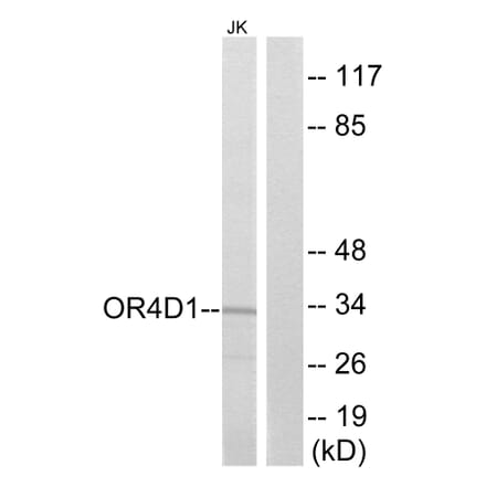 Western Blot - Anti-OR4D1 Antibody (G591) - Antibodies.com