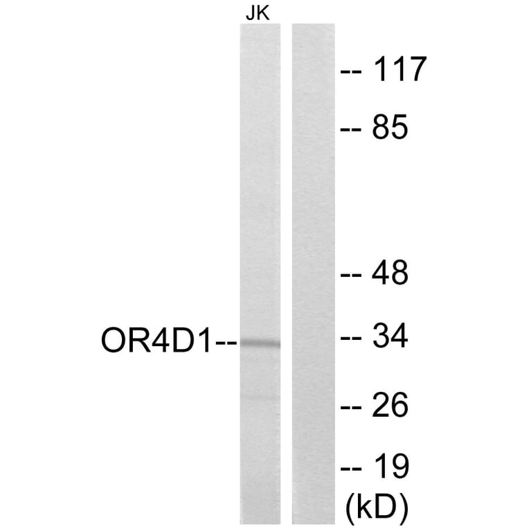 Western Blot - Anti-OR4D1 Antibody (G591) - Antibodies.com