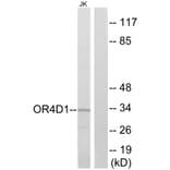 Western Blot - Anti-OR4D1 Antibody (G591) - Antibodies.com